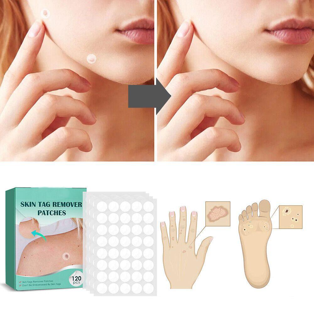 Ultra-Thin Protective Skin Patches