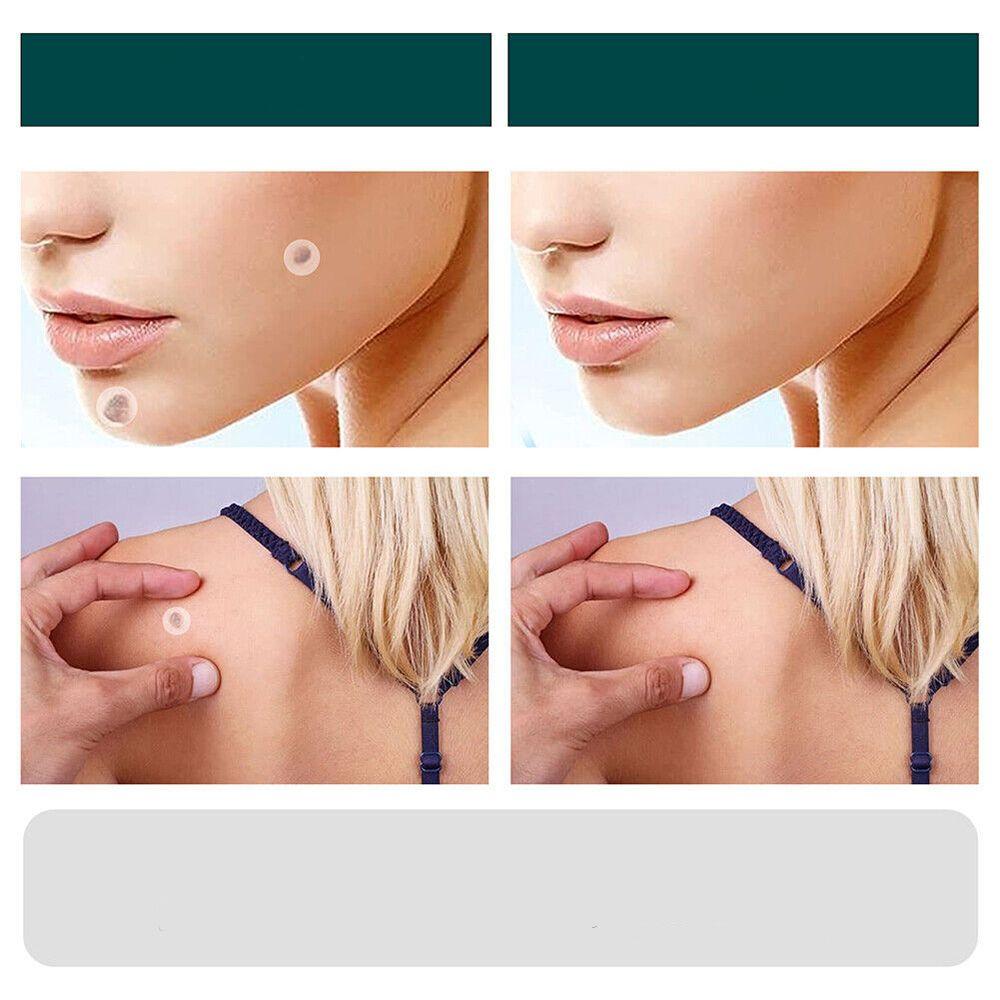 Ultra-Thin Protective Skin Patches