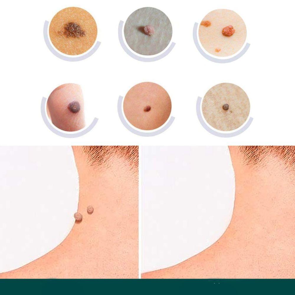 Ultra-Thin Protective Skin Patches
